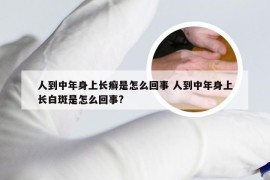 人到中年身上长癣是怎么回事 人到中年身上长白斑是怎么回事?