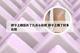 脖子上晒后长了几点小白斑 脖子上晒了好多白斑