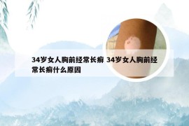 34岁女人胸前经常长癣 34岁女人胸前经常长癣什么原因