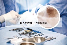 吃人的吃准分子治疗白斑