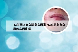 42岁腿上有白斑怎么回事 42岁腿上有白斑怎么回事呢