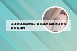 经络瘀堵身体寒湿引发银屑病 经络疏通对银屑病有用吗