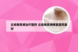 云南银屑病治疗医院 云南银屑病哪里医院最好