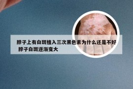 脖子上有白斑植入三次黑色素为什么还是不好 脖子白斑逐渐变大