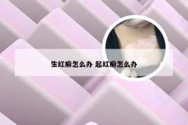 生红癣怎么办 起红癣怎么办