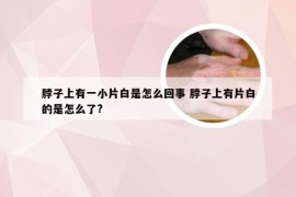 脖子上有一小片白是怎么回事 脖子上有片白的是怎么了?