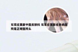 石家庄冀都中医皮肤科 石家庄冀都皮肤病医院是正规医院么