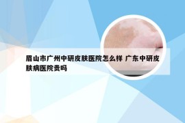 眉山市广州中研皮肤医院怎么样 广东中研皮肤病医院贵吗