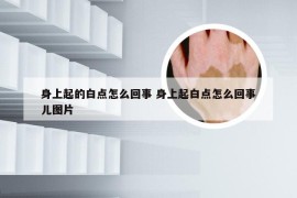 身上起的白点怎么回事 身上起白点怎么回事儿图片