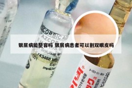 银屑病能整容吗 银屑病患者可以割双眼皮吗