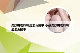 皮肤出现白斑是怎么回事 小孩皮肤出现白斑是怎么回事