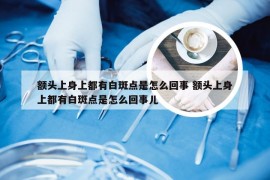 额头上身上都有白斑点是怎么回事 额头上身上都有白斑点是怎么回事儿