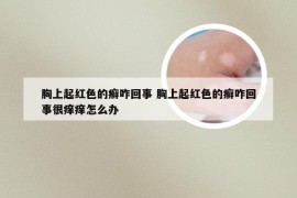 胸上起红色的癣咋回事 胸上起红色的癣咋回事很痒痒怎么办