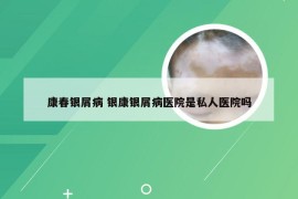 康春银屑病 银康银屑病医院是私人医院吗