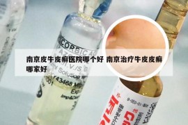 南京皮牛皮癣医院哪个好 南京治疗牛皮皮癣哪家好