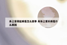 身上容易起癣是怎么回事 身体上爱长癣是什么原因