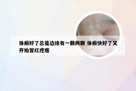 体癣好了总是边缘有一颗两颗 体癣快好了又开始冒红疙瘩