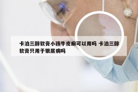 卡泊三醇软膏小孩牛皮癣可以用吗 卡泊三醇软膏只用于银屑病吗