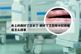 身上的癣好了又长了 癣好了之后有小红疙瘩是怎么回事