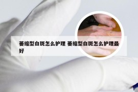 萎缩型白斑怎么护理 萎缩型白斑怎么护理最好