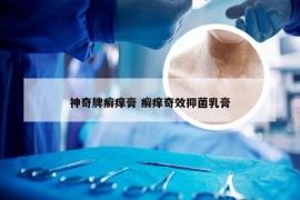 神奇牌癣痒膏 癣痒奇效抑菌乳膏