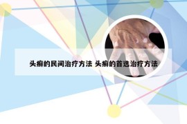 头癣的民间治疗方法 头癣的首选治疗方法