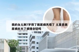 我的女儿刚7岁得了银屑病天塌了 儿童患银屑病长大了病情会轻吗