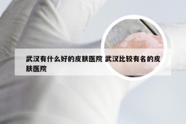 武汉有什么好的皮肤医院 武汉比较有名的皮肤医院