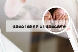 银屑病白疕病常用药 白疕银屑病临床可分