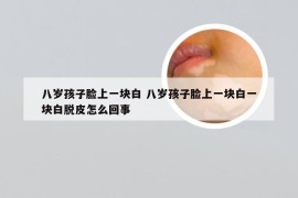 八岁孩子脸上一块白 八岁孩子脸上一块白一块白脱皮怎么回事