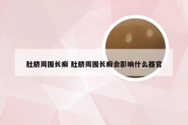 肚脐周围长癣 肚脐周围长癣会影响什么器官