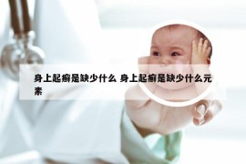 身上起癣是缺少什么 身上起癣是缺少什么元素