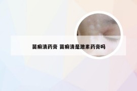 苗癣清药膏 苗癣清是激素药膏吗