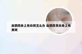 血鹦鹉身上有白斑怎么办 血鹦鹉发白身上有黑斑