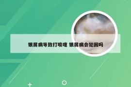 银屑病导致打喷嚏 银屑病会犯困吗