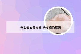 什么偏方是皮癣 治皮癣的草药