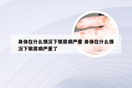 身体在什么情况下银屑病严重 身体在什么情况下银屑病严重了