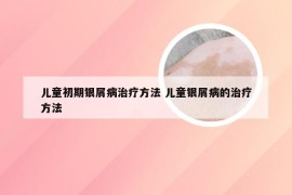 儿童初期银屑病治疗方法 儿童银屑病的治疗方法