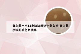 身上起一小11小块块癣这个怎么治 身上起小块的癣怎么回事