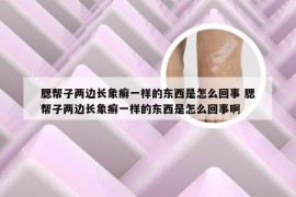 腮帮子两边长象癣一样的东西是怎么回事 腮帮子两边长象癣一样的东西是怎么回事啊