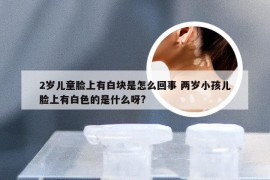 2岁儿童脸上有白块是怎么回事 两岁小孩儿脸上有白色的是什么呀?