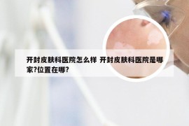 开封皮肤科医院怎么样 开封皮肤科医院是哪家?位置在哪?