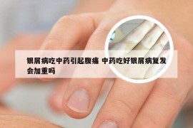 银屑病吃中药引起腹痛 中药吃好银屑病复发会加重吗