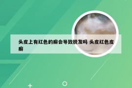 头皮上有红色的癣会导致脱发吗 头皮红色皮癣