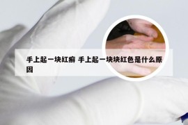 手上起一块红癣 手上起一块块红色是什么原因