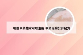 哪些中药熬水可以治癣 中药治癣公开秘方