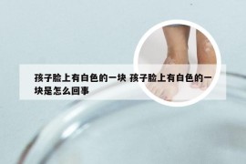 孩子脸上有白色的一块 孩子脸上有白色的一块是怎么回事