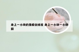 身上一小块的像癣会掉皮 身上一小块一小块藓