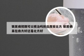 银屑病初期可以根治吗挑选西安北方 银屑病呆在南方好还是北方好