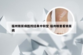 福州银屑病医院经典中和堂 福州哪里看银屑病